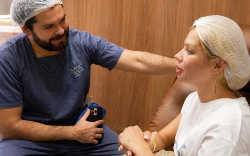 Janaína Santucci celebra pós-operatório tranquilo após lifting facial endoscópico com Dr. Bruno Alberton